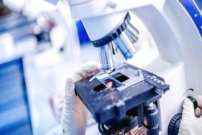 Analiza polnih hormona kod žena: estradiol, FSH, LH, prolaktin, progesteron, testosteron